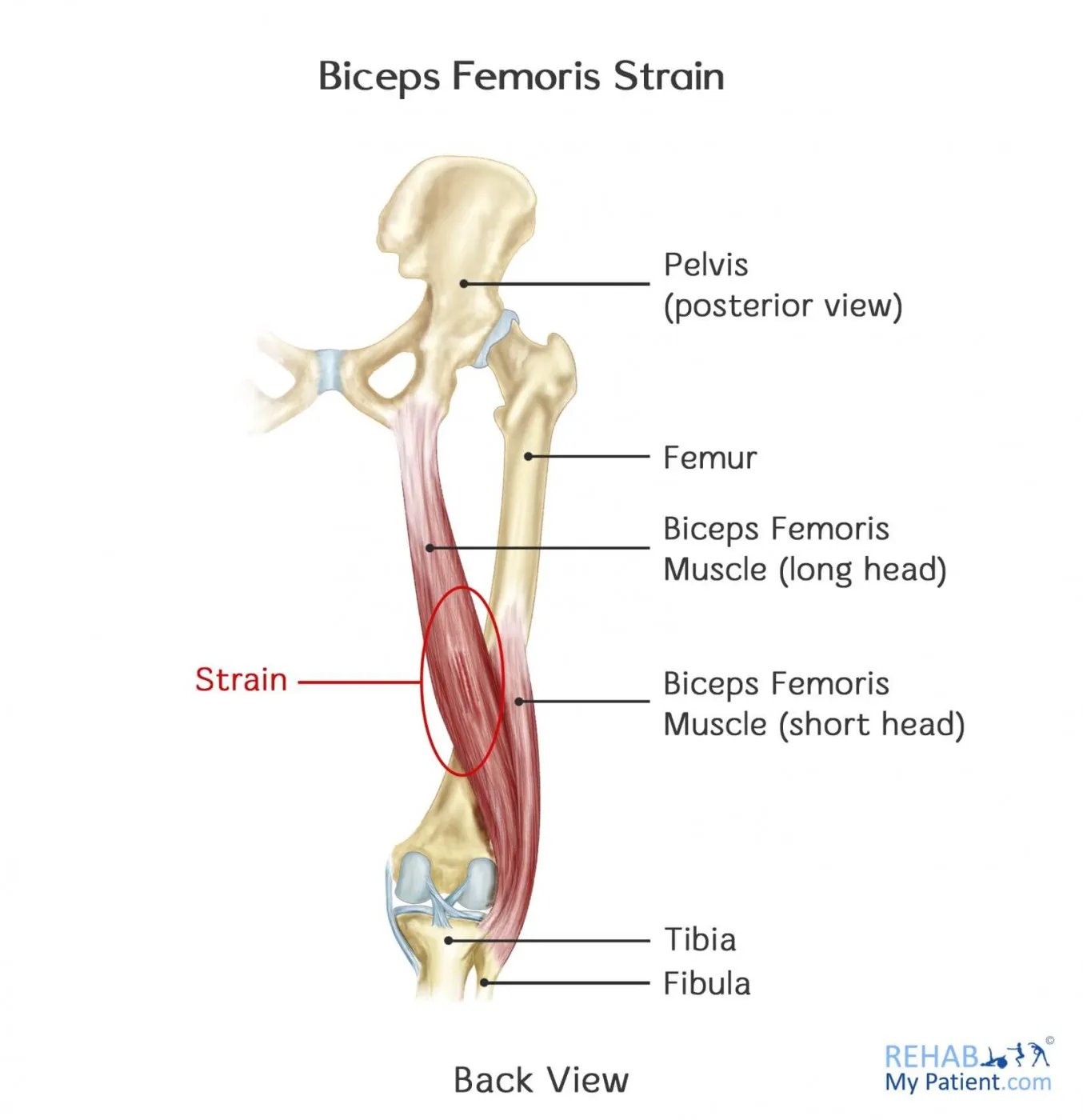 Biceps femoris